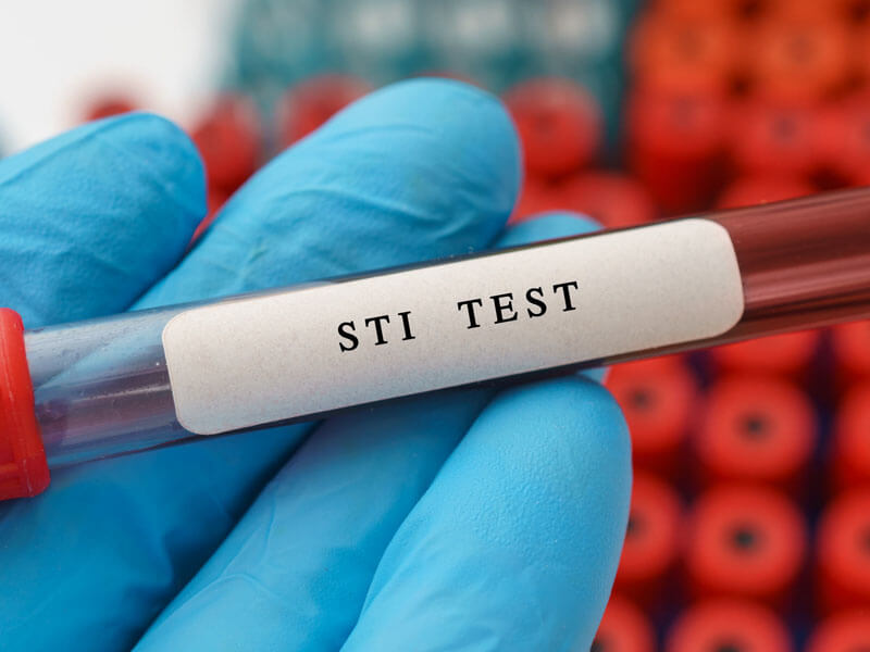 STI Testing at Sexual Health Clinics