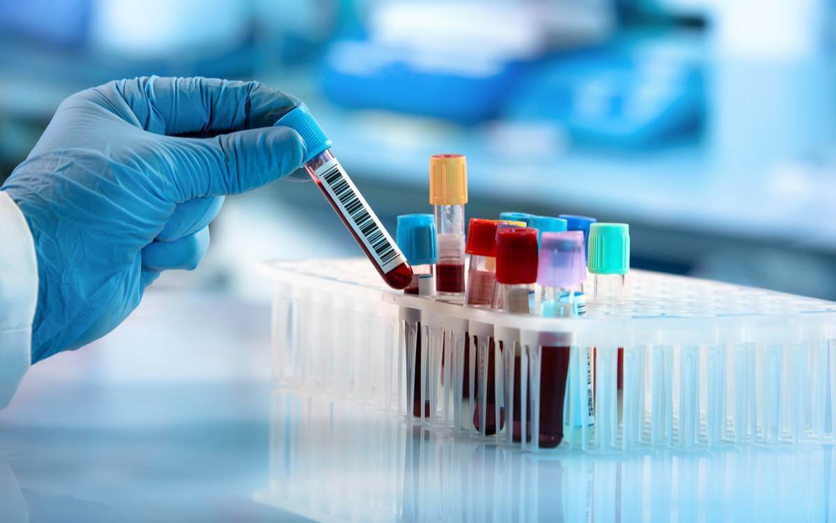 STI Testing and Vaccination