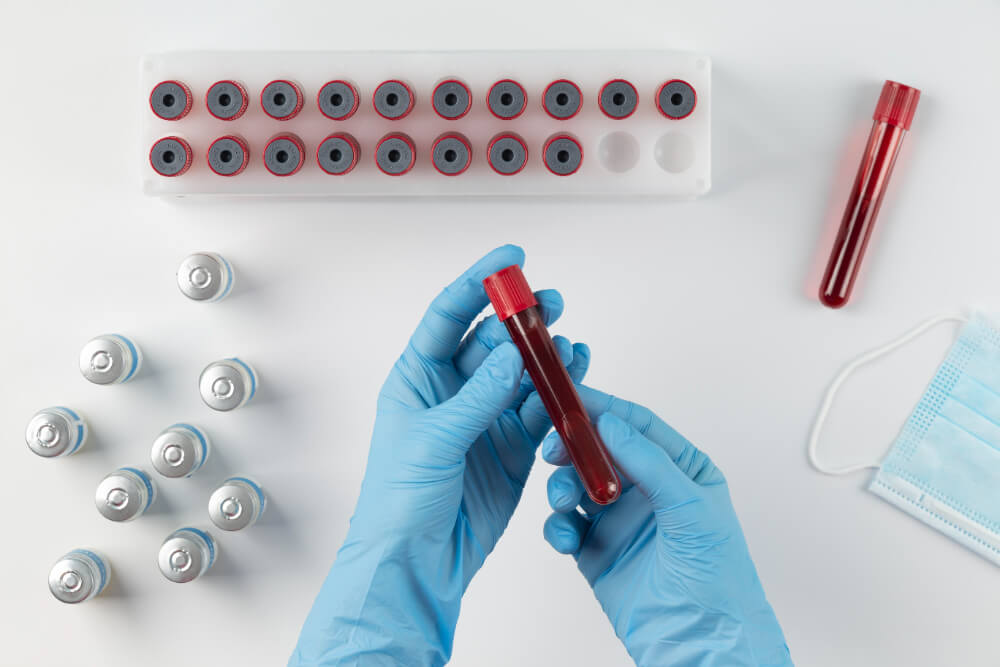 The Importance of Syphilis Testing 