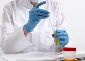 Gonorrhea STI Testing