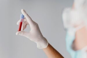 back-view-doctor-holding-blood-sample