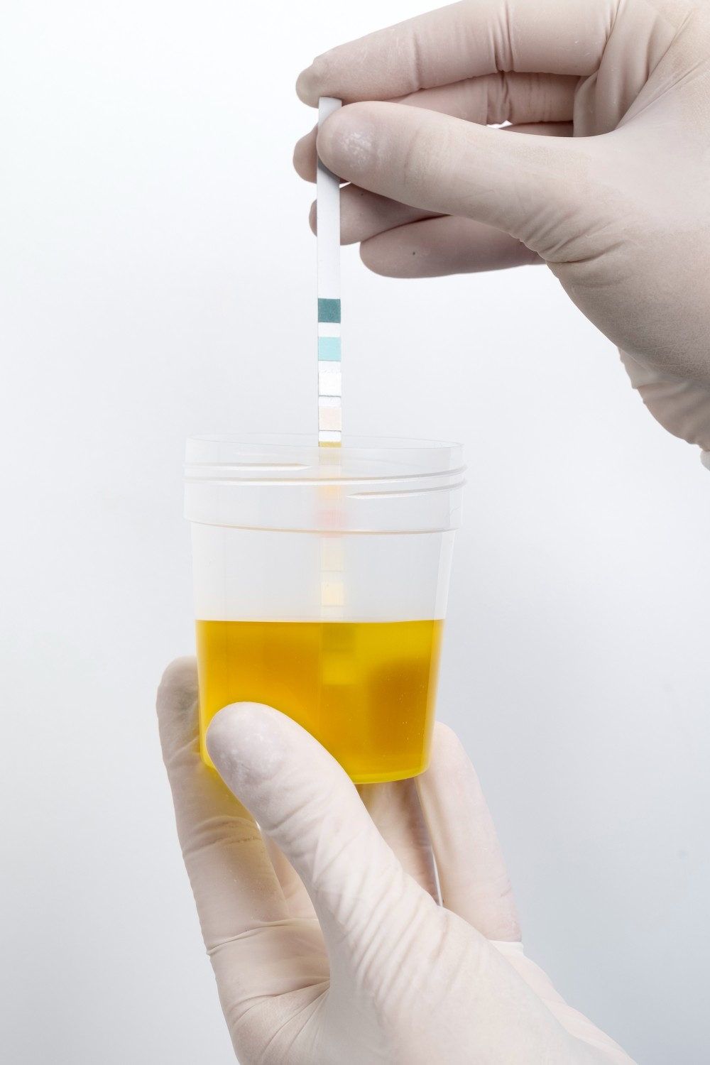 STI testing