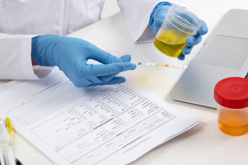 STI Testing